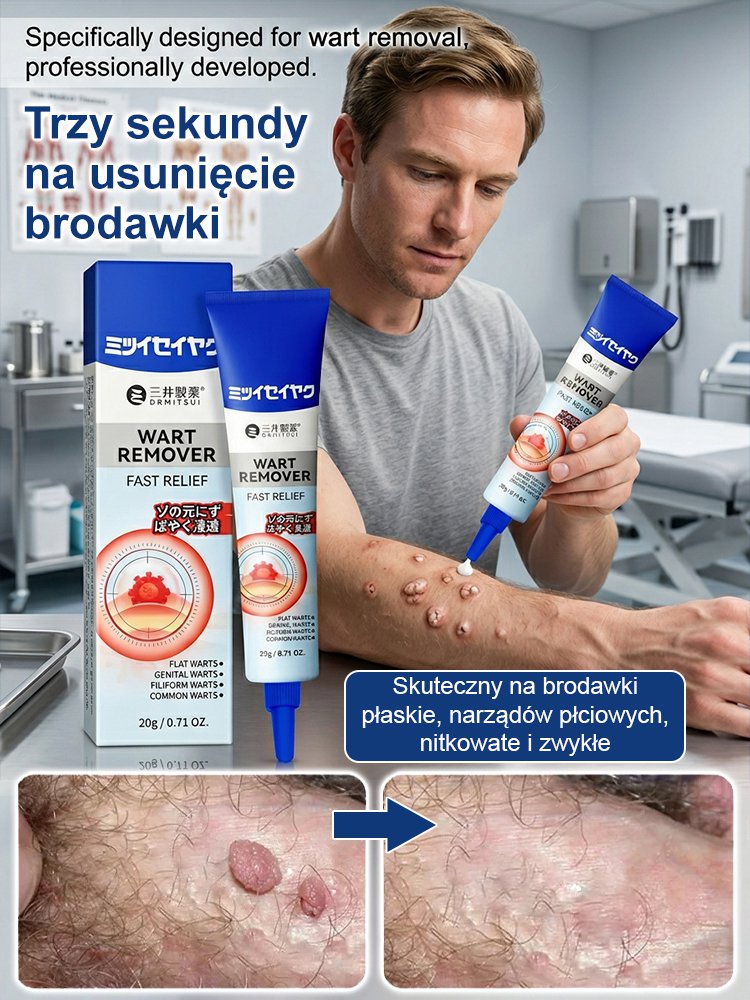 【Trzy sekundy na usunięcie brodawek】Japońska maść Mitsui Pharmaceutical na brodawki