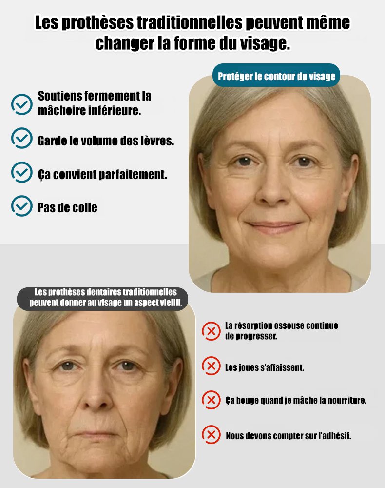 Kit de restauration dentaire esthétique