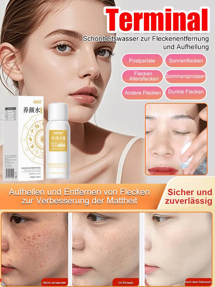 【Verschiedene Flecken - Ein Sprühstoß entfernt alles】Aufhellendes Anti-Flecken-Spray
