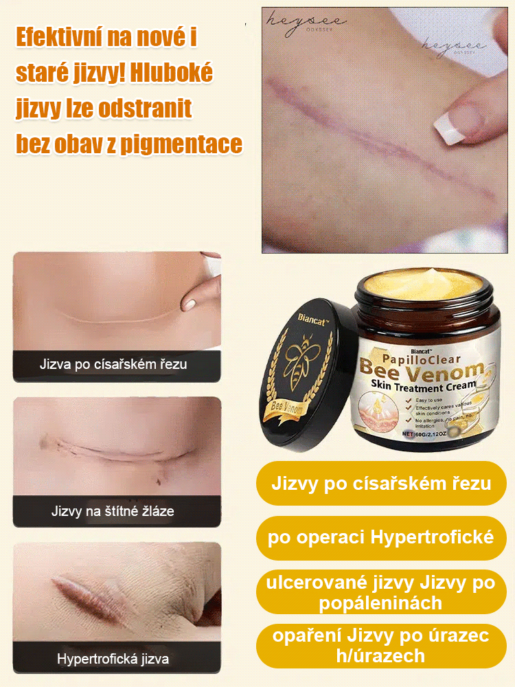 Včelí jed krém na vyhlazení jizev na pokožce