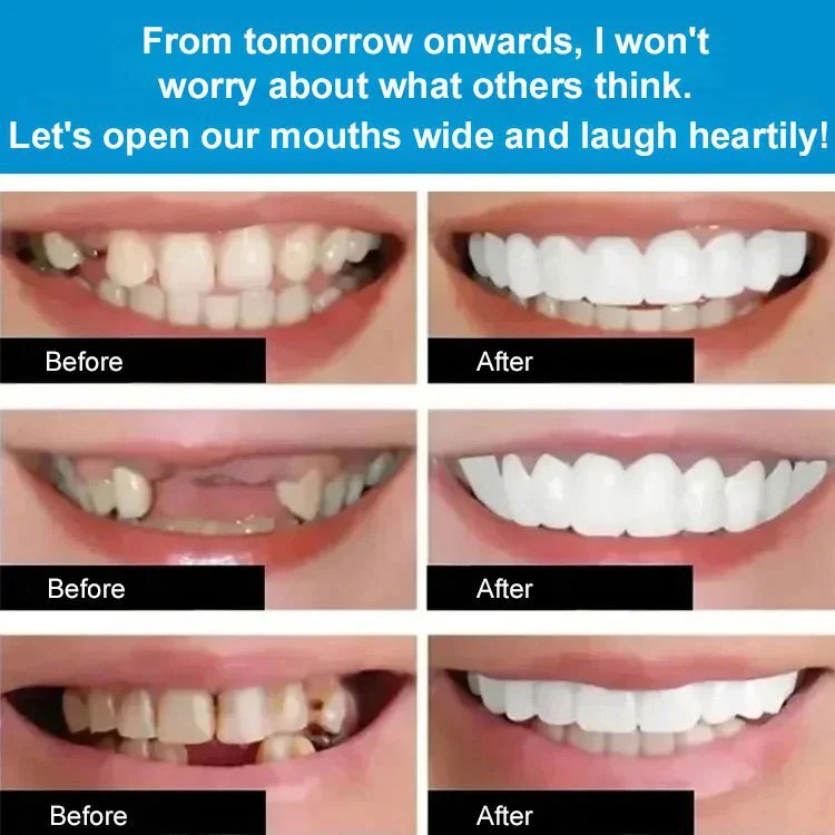 ORALHOE denture modification kit (with teether)
