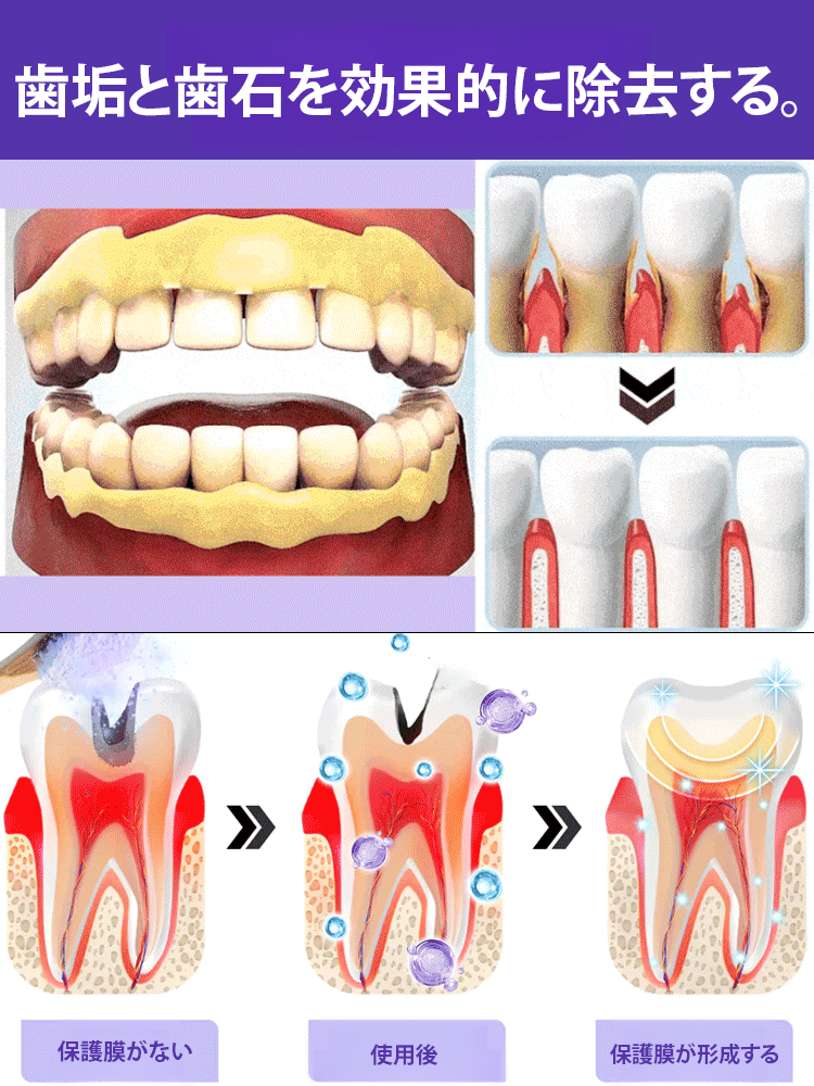 歯の修復ミネラルパウダー
