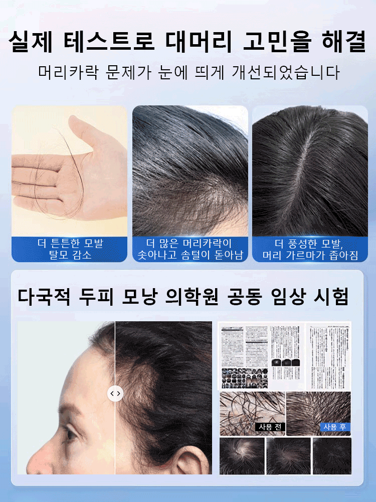 【인기 상품】X 탈모 혁신 앰플