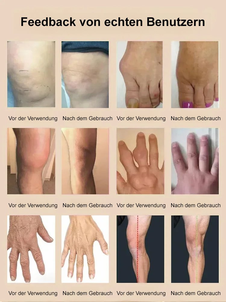 【Wo es weh tut, da auftragen】Glucosamin-Gelenkpflegesalbe