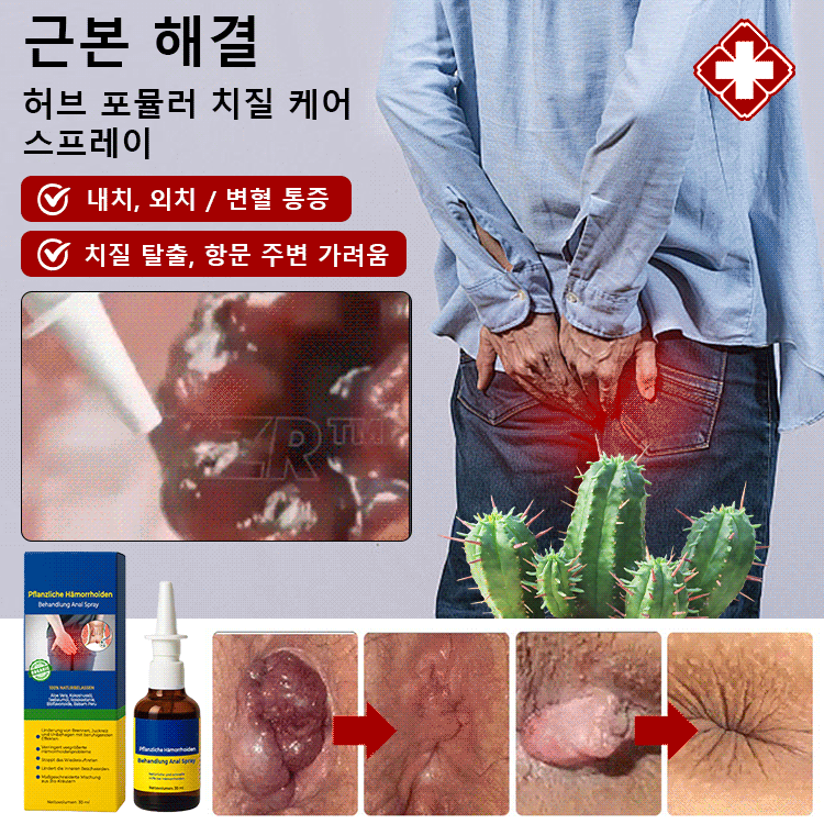 허브 포뮬러 치질 케어 스프레이