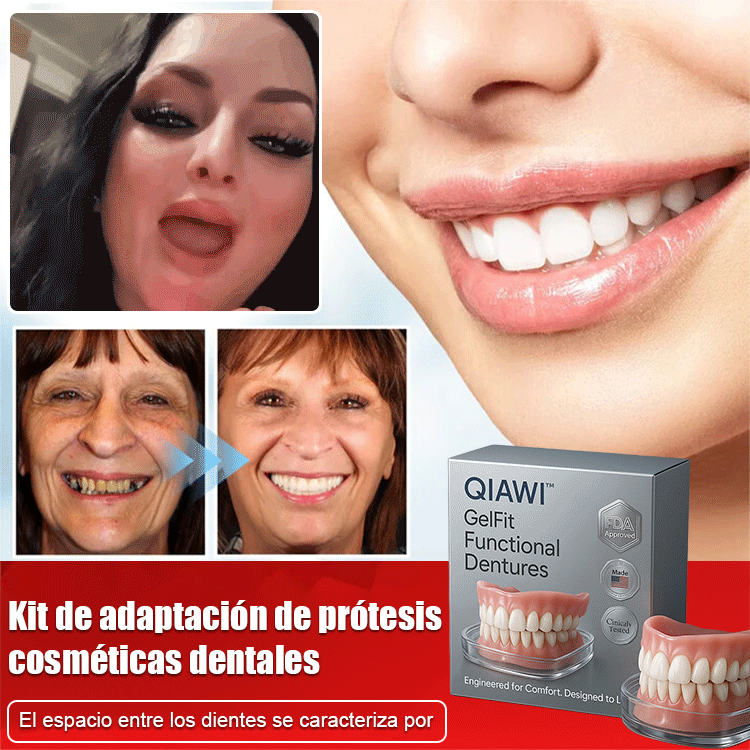 Conjunto de carillas cosméticas para dientes.