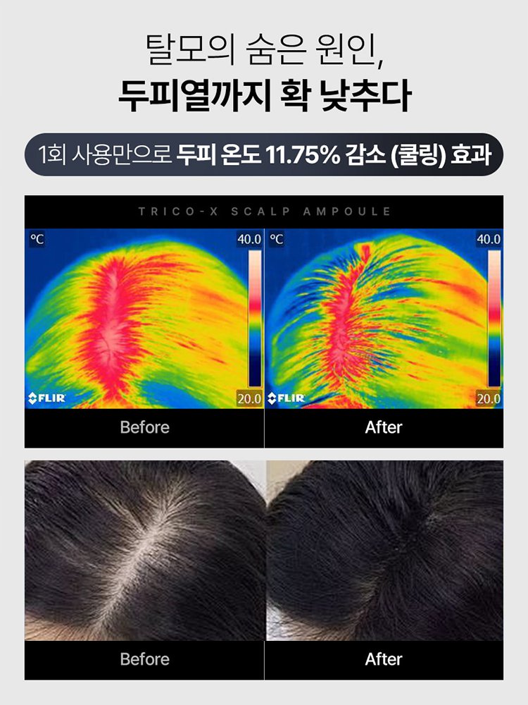 【인기 상품】X 탈모 혁신 앰플
