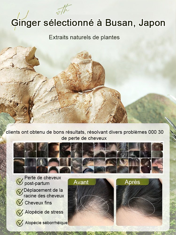 Hot Sale Ginger Plant Extract Anti-Hair Loss Hair Shampooing