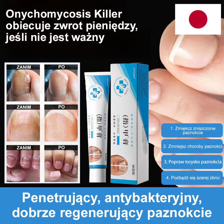 [Bezbolesne i bez nawrotów] Maść na grzybicę paznokci