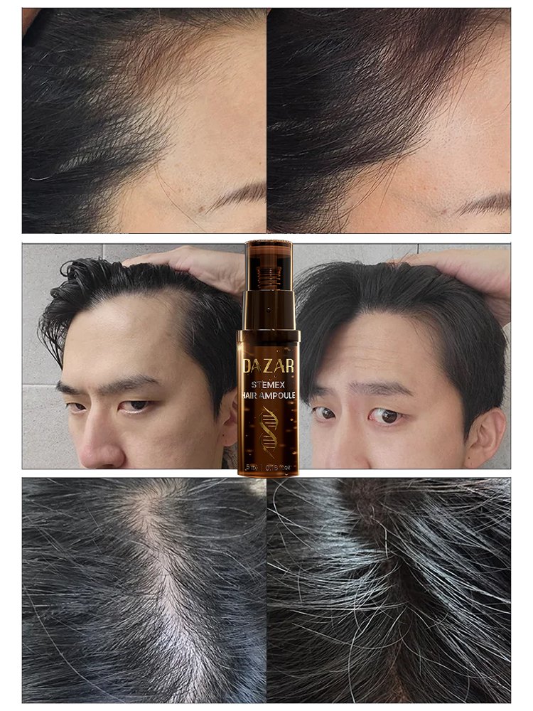 MTS 탈모 방지 헤어 앰플