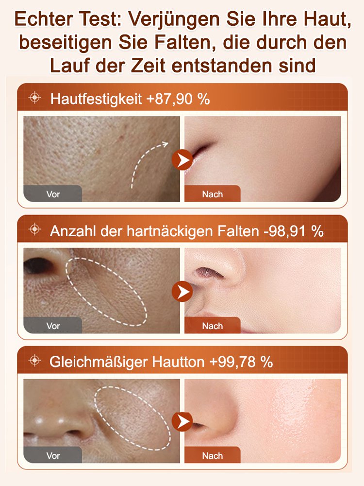 [Falten in Sekunden entfernen] Ecdoin Anti-Aging-Essenz