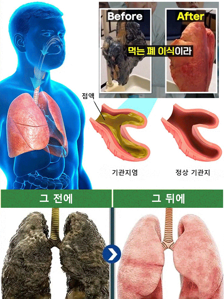 【폐 클리너】목 건강과 폐 정화 해독제