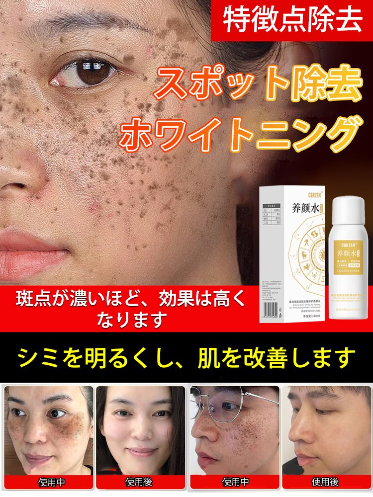 【シミに直接スプレーしてケア】美白効果のある化粧水スプレー