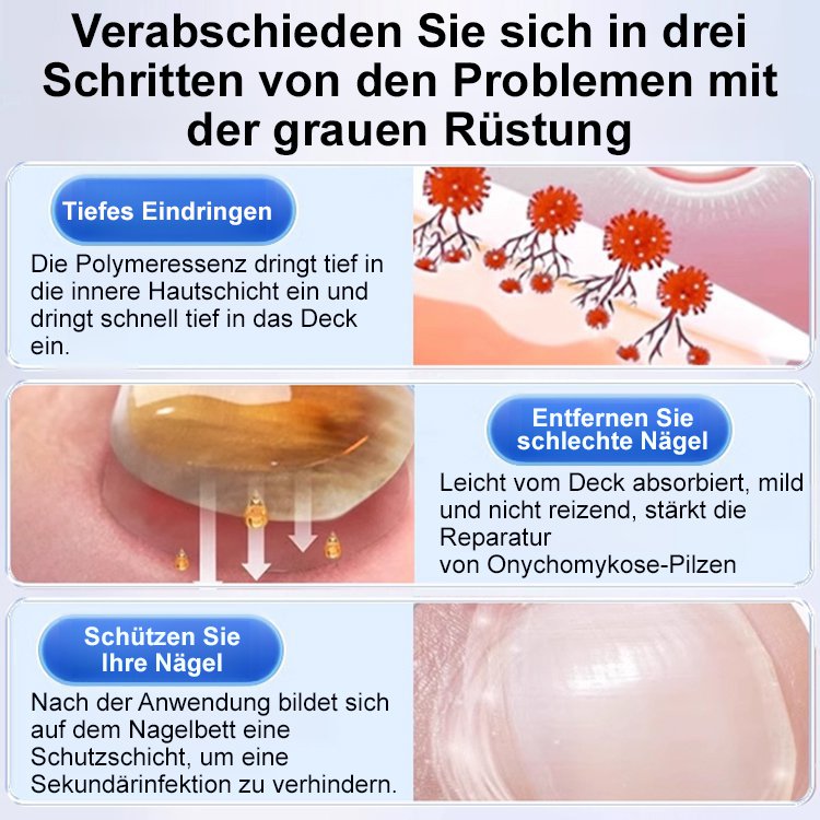 [Schmerzlos und kein Wiederauftreten] Onychomykosesalbe