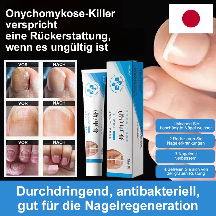 [Schmerzlos und kein Wiederauftreten] Onychomykosesalbe