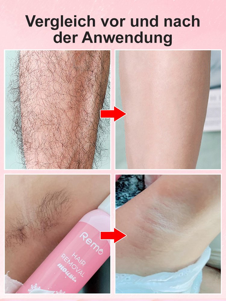 Remo Haarentfernungs-Mousse