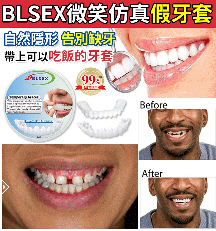 BLSEX微笑仿真假牙套