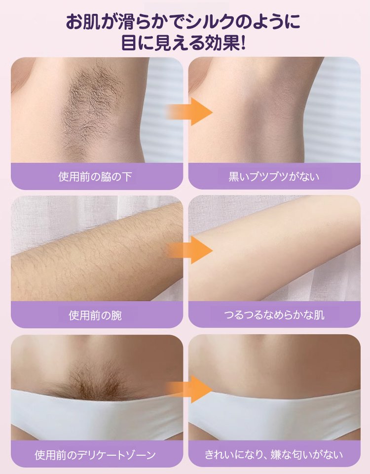 【プロ級脱毛器】3秒除毛・根元から除去！8週で永久脱毛！  