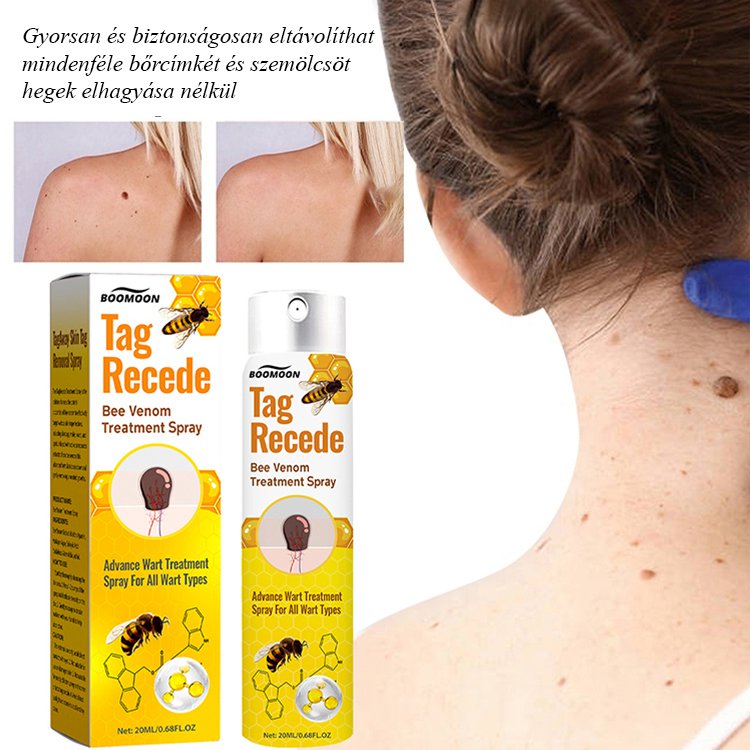  Bee Venom szemölcsök ápoló spray