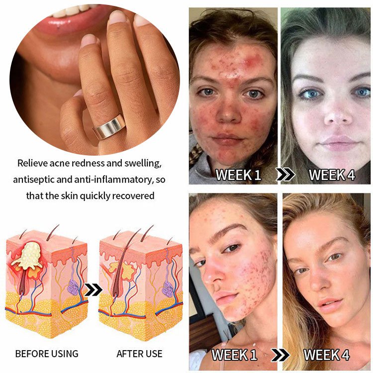 Magnetic Ring Health Ring