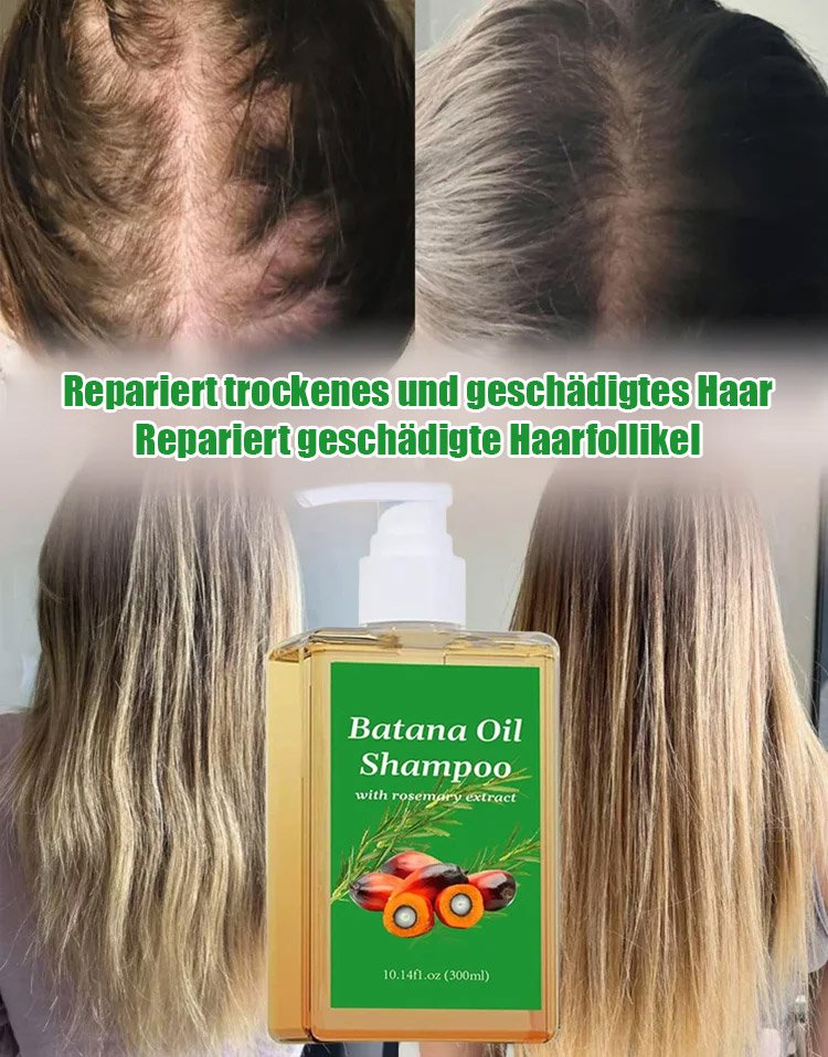 【Rapid hair growth in 7 days!】Hair growth shampoo