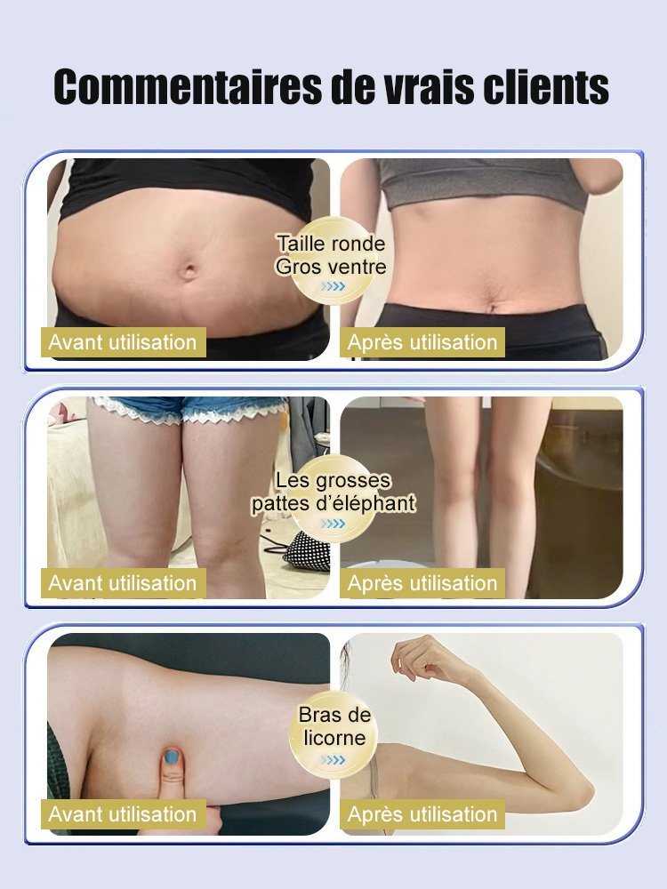 【Formule à base de plantes】 Patch de point d'acupuncture pour éliminer l'humidité.