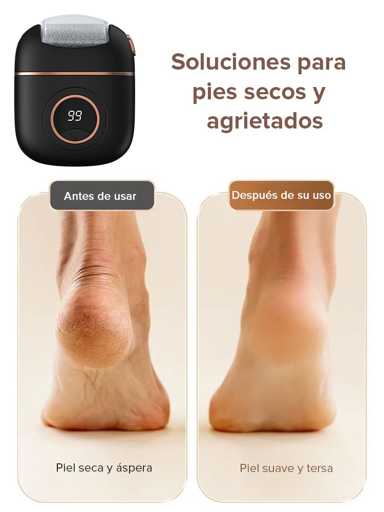 【Elimina la piel muerta en segundos】 Nuevo molinillo de pies eléctrico con pantalla digital