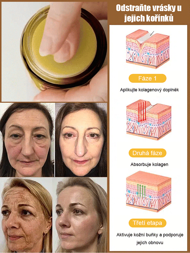 Včelí jed krém na vyhlazení jizev na pokožce