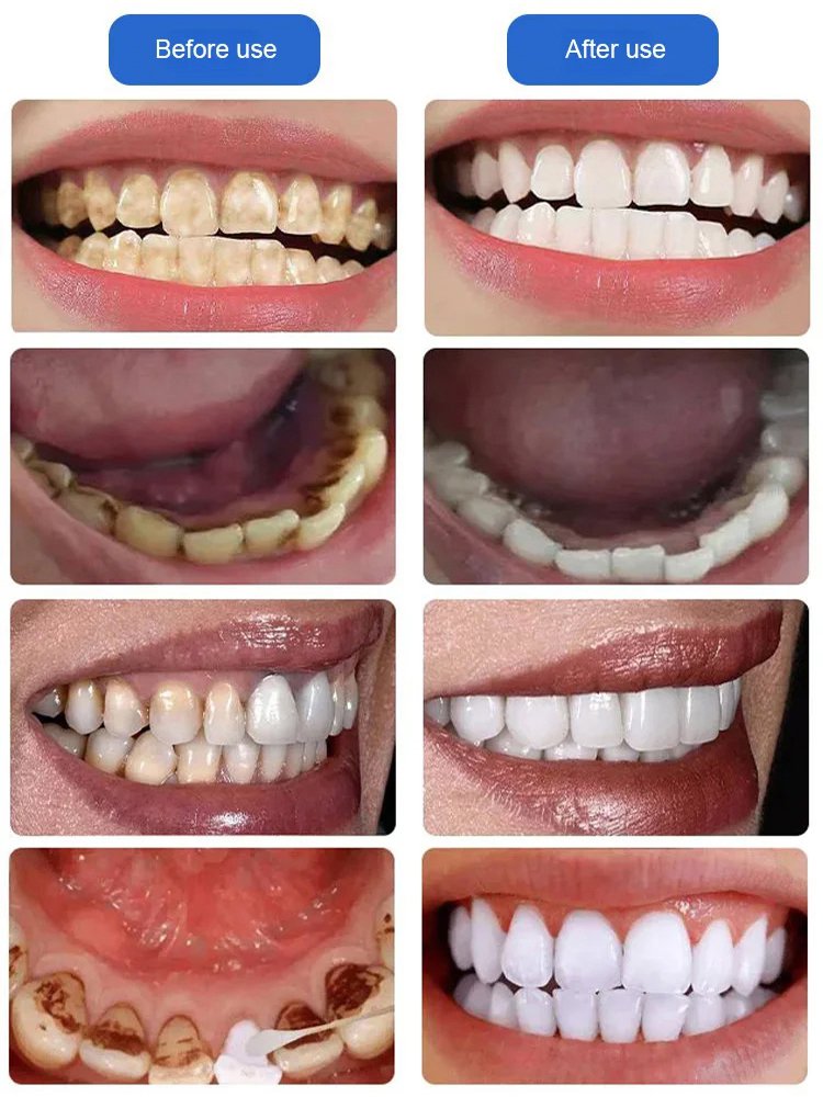 Dental care kit
