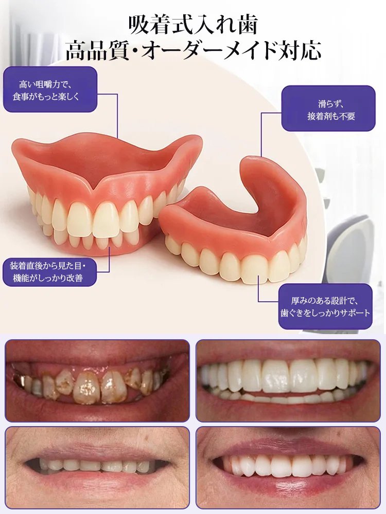 審美用マウスピース，スイス輸入品、口いっぱいのスイス製、そして高貴な身分の象徴！！