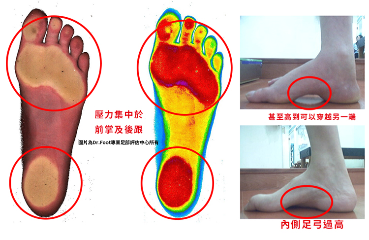 1597145106701321.jpg 噱頭_03.jpg