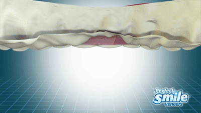 03.gif