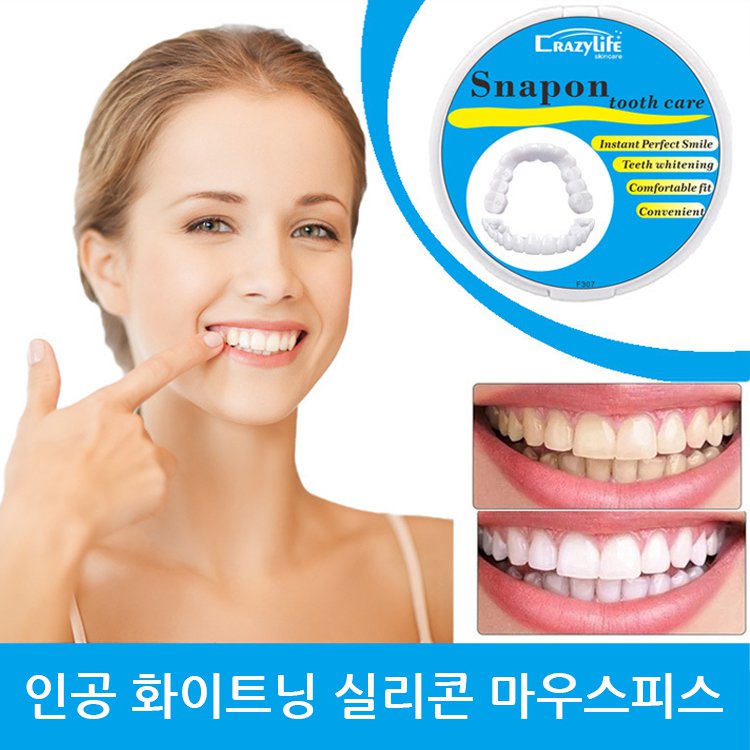 화이트닝 인공 마우스피스