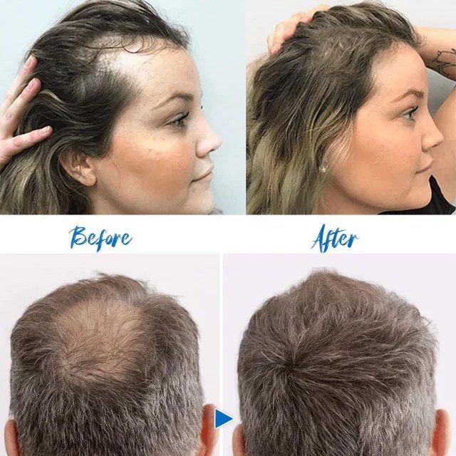 ショウガ育毛パウダー