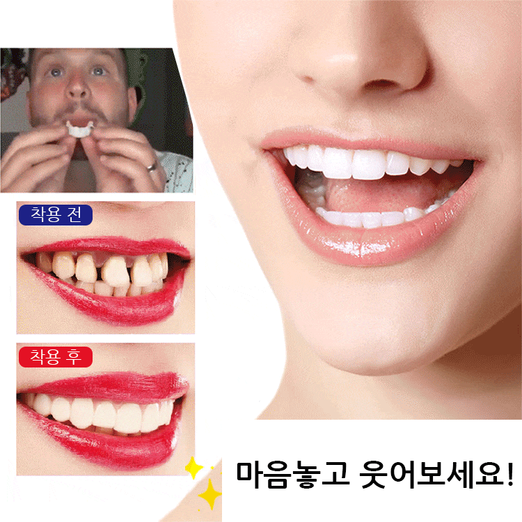 화이트닝 인공 마우스피스