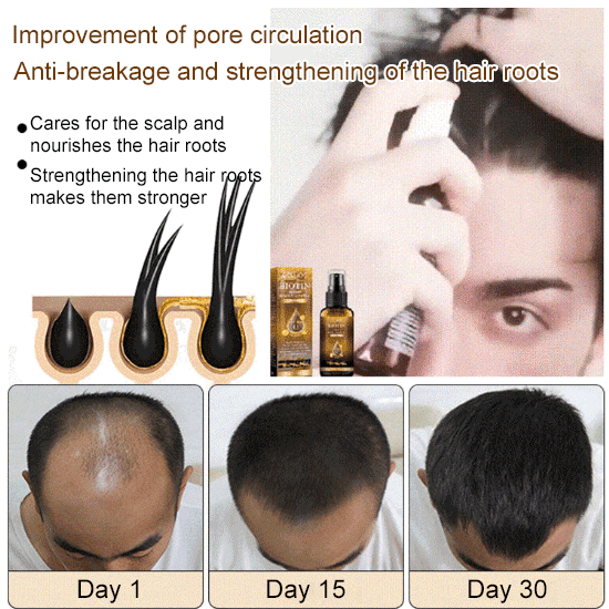 Biotin Hair Growth Spray