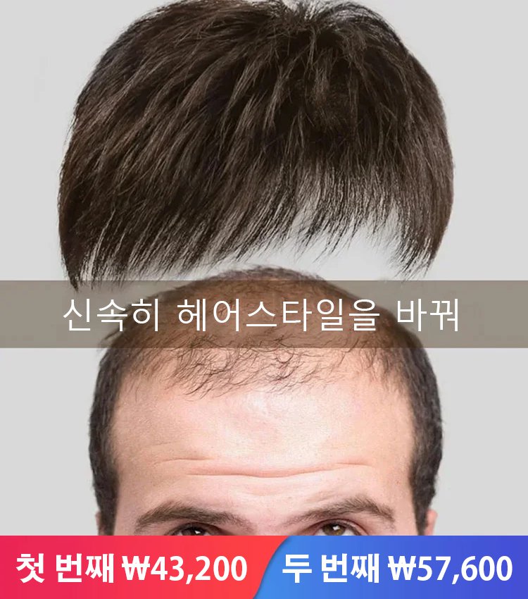 정수리 시뮬레이션 헴라인 가발
