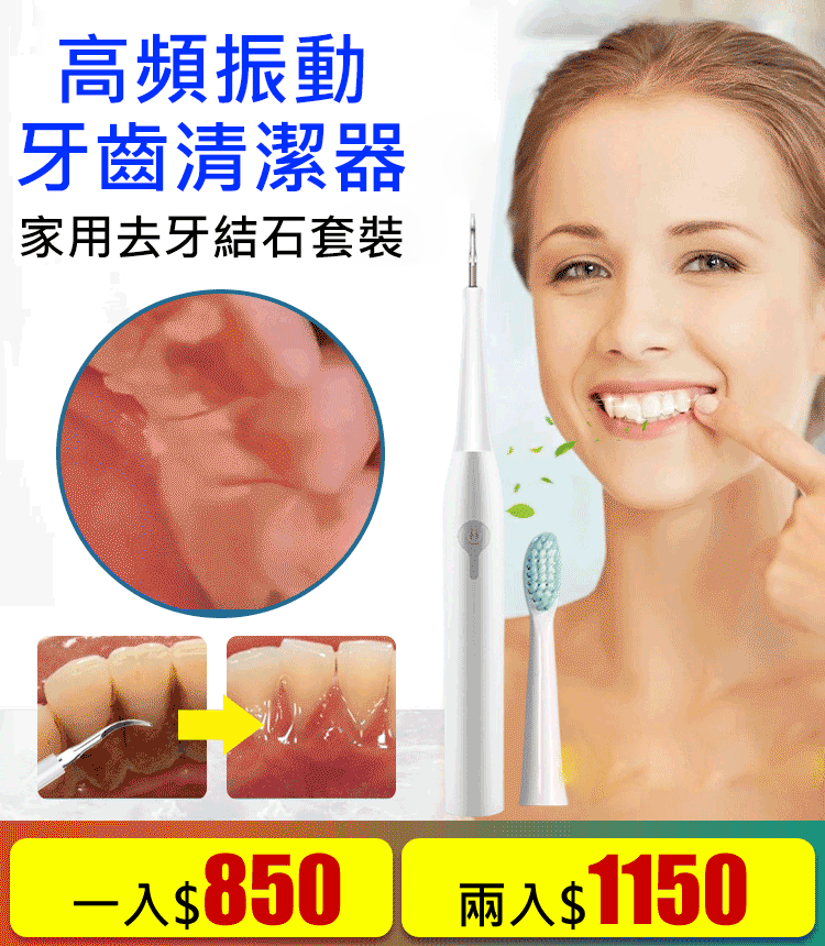 洗牙儀