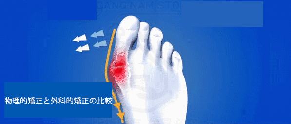 最後の1時間は半額!【足の専門医が推薦】男女兼用矯正用5本指浅履きソックス、効果がなければ全額返金保証！ - detail 12