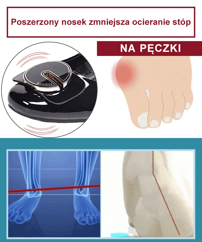 Czółenka z lakierowanej skóry