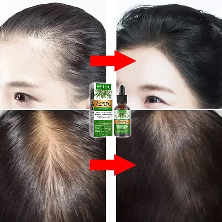ätherisches öl für haarwachstum