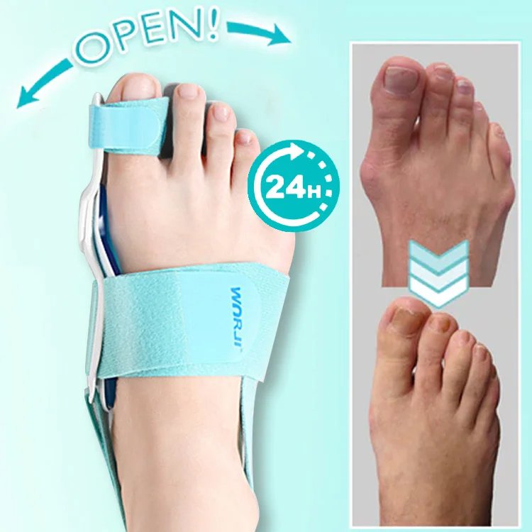 무지외반 교정기