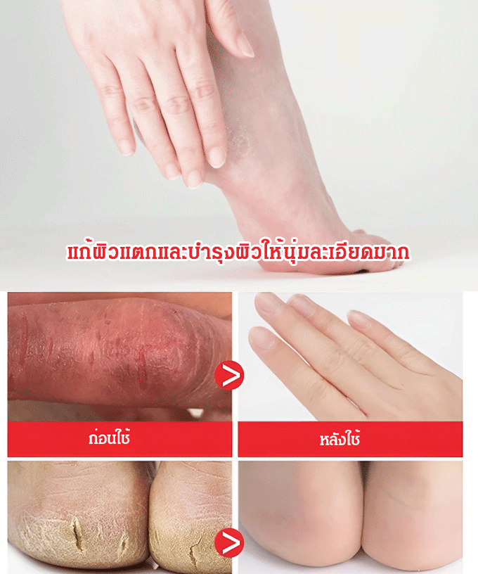 ครีมทามือน้ำมันม้าให้ความชุ่มชื้นป้องกันการแตกร้าว