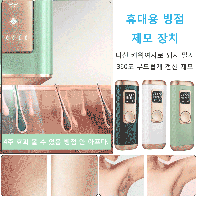 가정용 IPL제모기