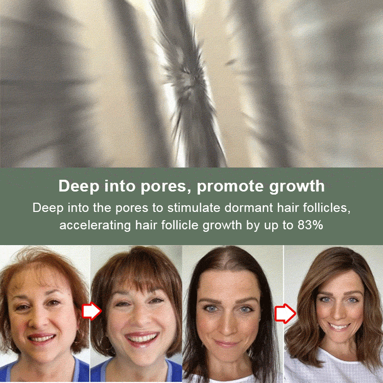 Polygonum multiflorum handmade hair growth soap