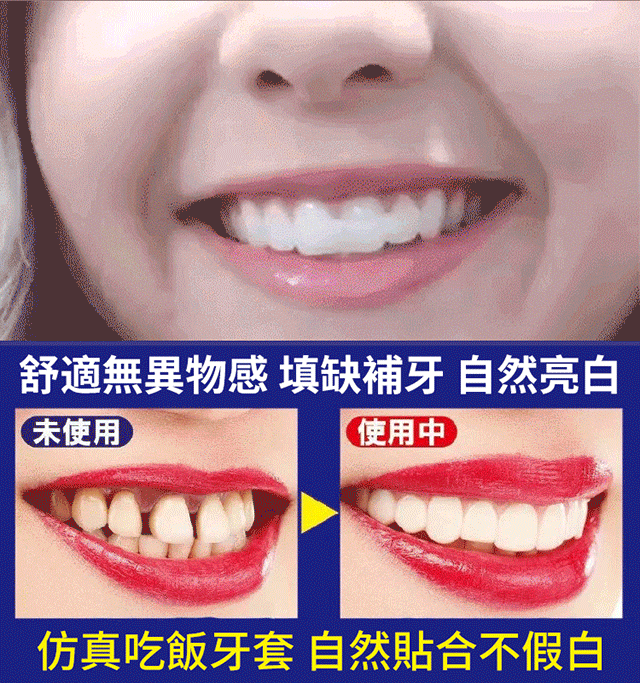 BLSEX微笑仿真假牙套