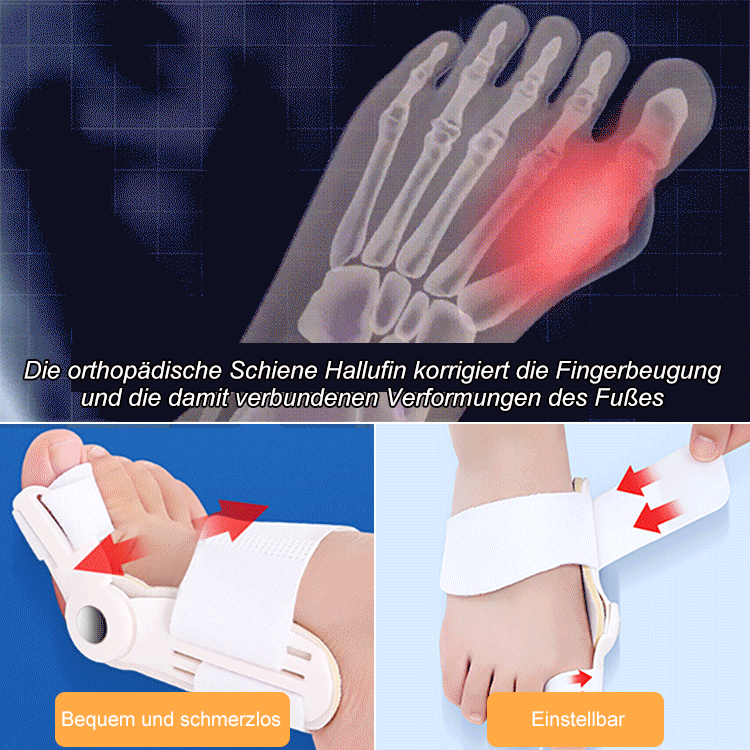 【Vom Arzt empfohlen】 Unisex-Bunion-Korrektor