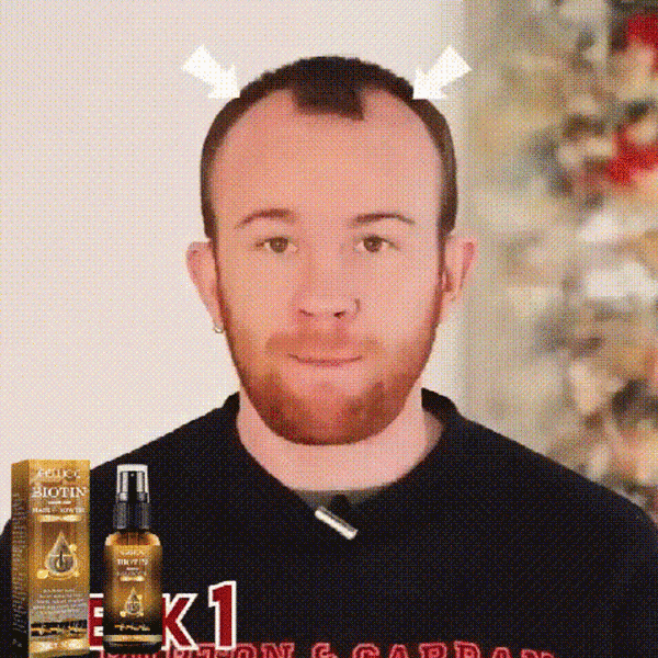 Biotin Hair Growth Spray