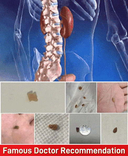 【Intangible heritage of ancient formula 】 Nourishing liver and protecting kidney herbal stone cleari